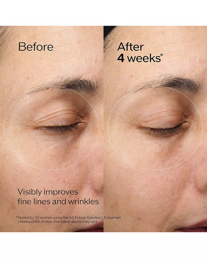 Kem Dưỡng Tái Tạo Vùng Mắt Và Môi Shiseido Future Solution LX
